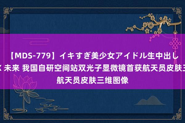 【MDS-779】イキすぎ美少女アイドル生中出し解禁SEX 未来 我国自研空间站双光子显微镜首获航天员皮肤三维图像